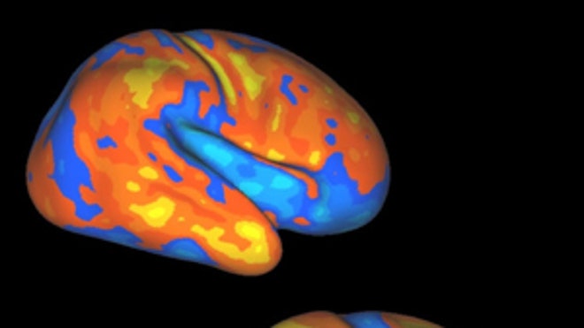 Brain Expansion Compared